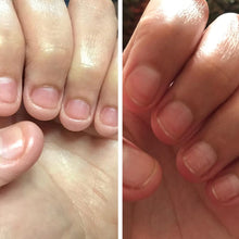 Load image into Gallery viewer, Nail Nutrient Oil Pen