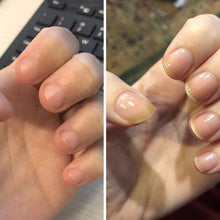 Load image into Gallery viewer, Nail Nutrient Oil Pen