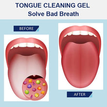 Load image into Gallery viewer, Tongue Cleaning Gel Set