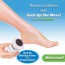Load image into Gallery viewer, Hirundo Foot File and Callus Remover