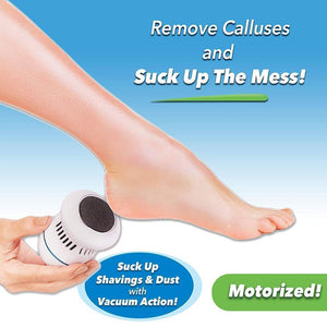 Hirundo Foot File and Callus Remover