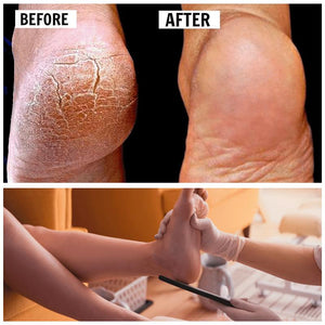2021 New Pedicure Foot File