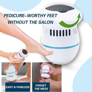 Hirundo Foot File and Callus Remover