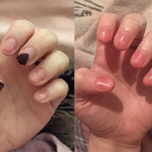 Load image into Gallery viewer, Nail Nutrient Oil Pen